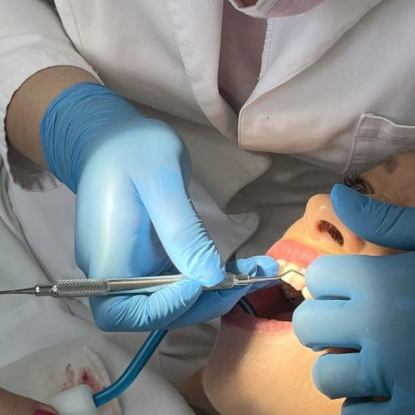 dental25